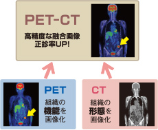 PET-CTとは