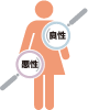 良性・悪性も見分けます！