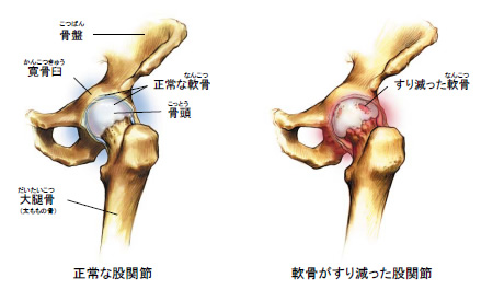 股関節