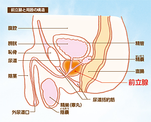 前立腺がん