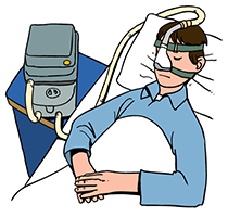睡眠時無呼吸症候群の治療