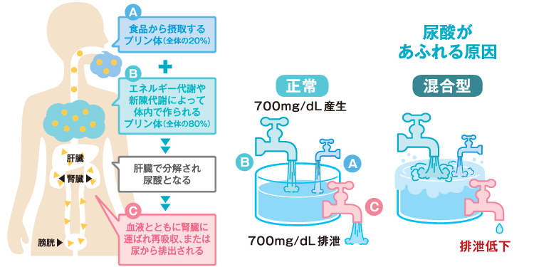 プリン体と尿酸の関係