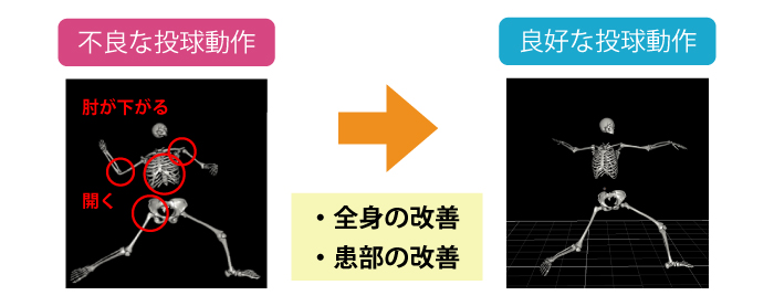 不良な投球動作・良好な投球動作