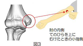 図3
