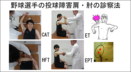 野球選手の投球障害肩・肘の診察法