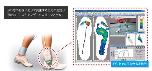 下肢加重検査のイメージ