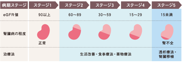 病期ステージごとにおける慢性腎臓病(CKD)の進行