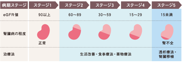 病期ステージごとにおける慢性腎臓病（CKD）の進行