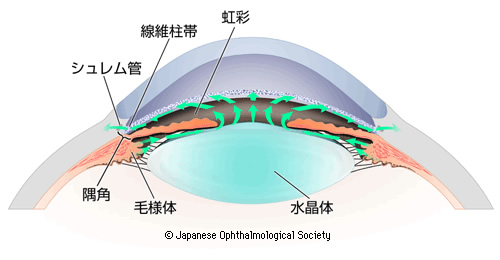 緑内障の症状