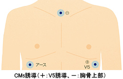 装着イメージ