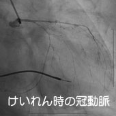 けいれん時