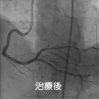 医療後