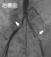 治療前