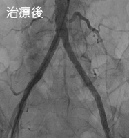 治療後