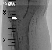 治療前