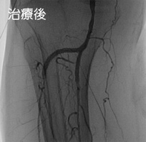 治療後