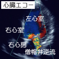 心臓エコー