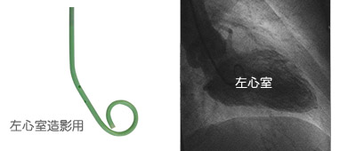 左心室造影