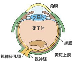 黄斑前膜の症状