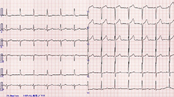 心電図